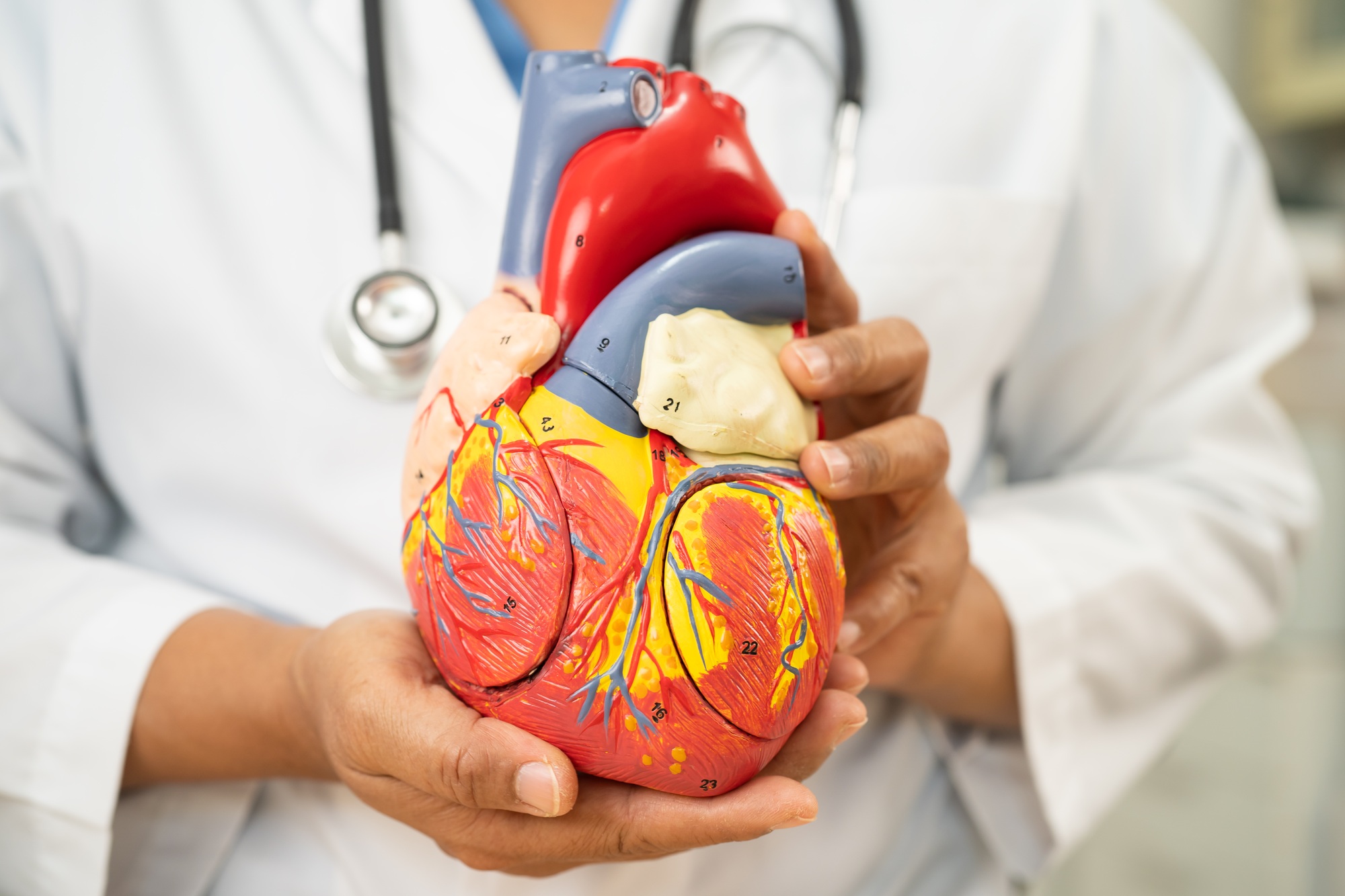 Cardiovascular disease CVD, Asian doctor holding human anatomy model for learn