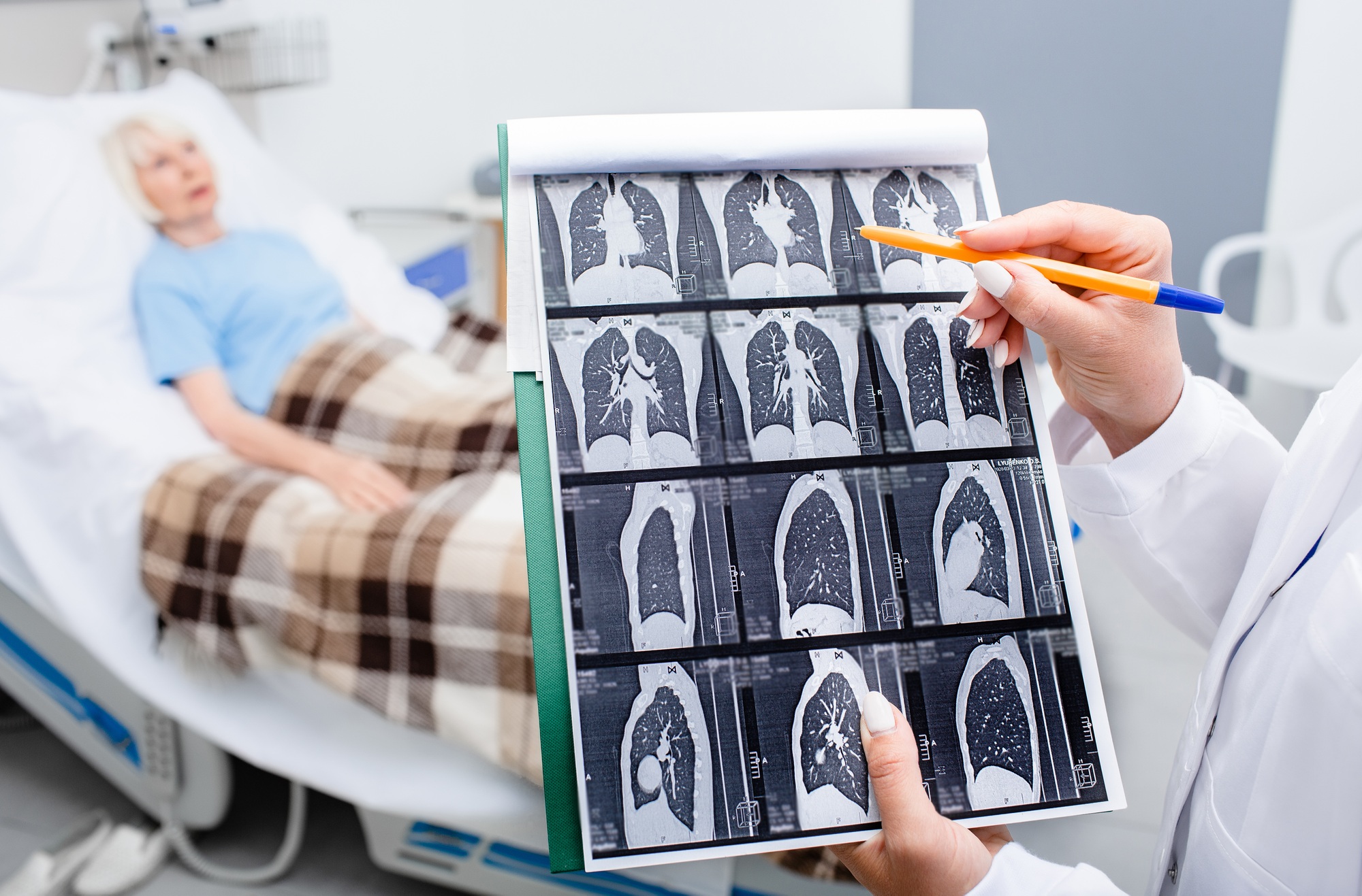 Close-up CT lung screening. Diagnostics and treatment of patients with pneumonia and lung diseases
