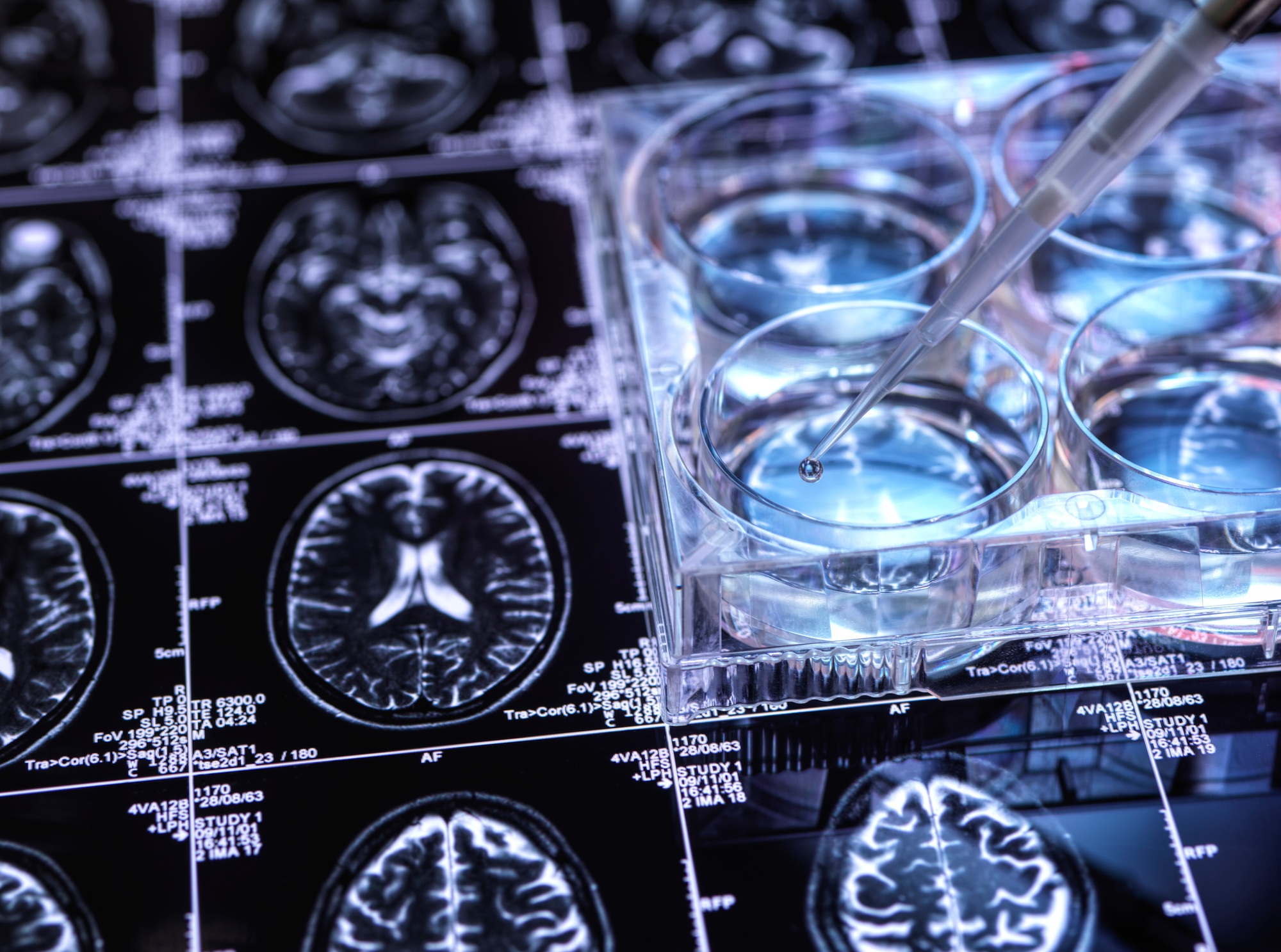 Petri dish on brains can