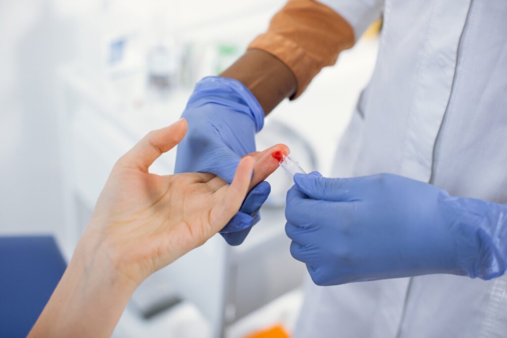 Unrecognizable female African American health worker doing a finger prick test for HIV, drawing