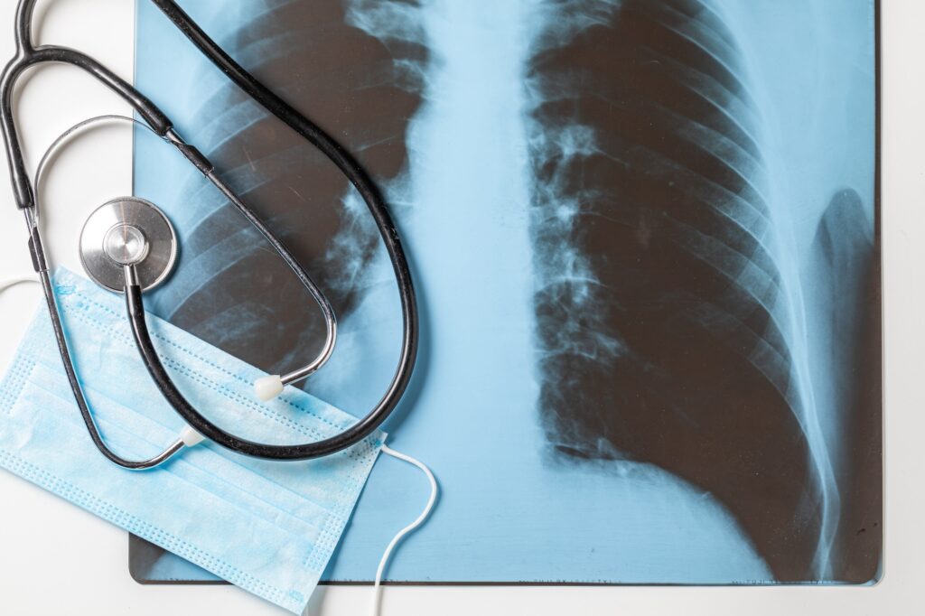 X-ray of sick lungs for coronavirus, mask and stethoscope